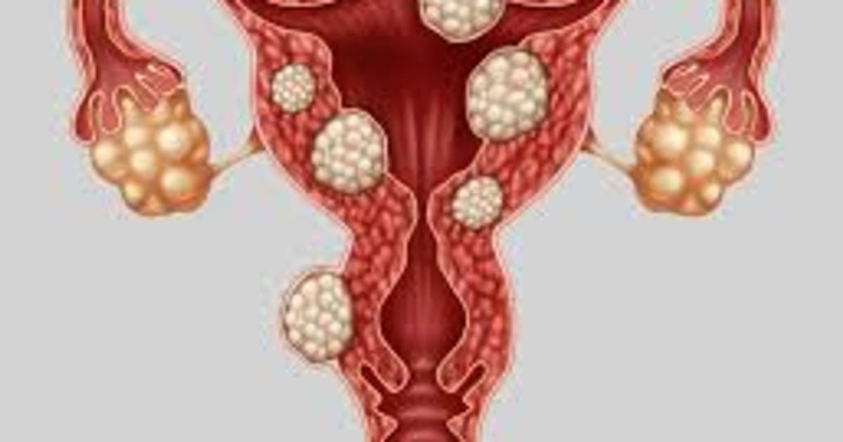 Micronutrition et Endométriose : 3 piliers pour mieux vivre au quotidien